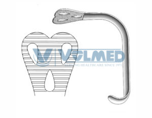 Wieder Cheek & Tongue Depressor - Length = 14 cm / 5-1/2", Tip = 36 mm